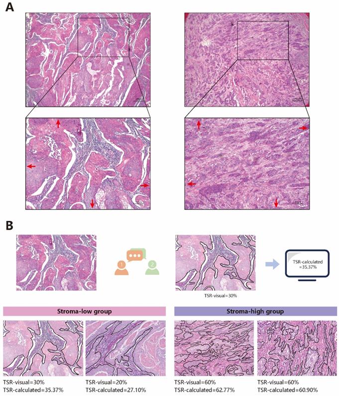 J Cancer Image