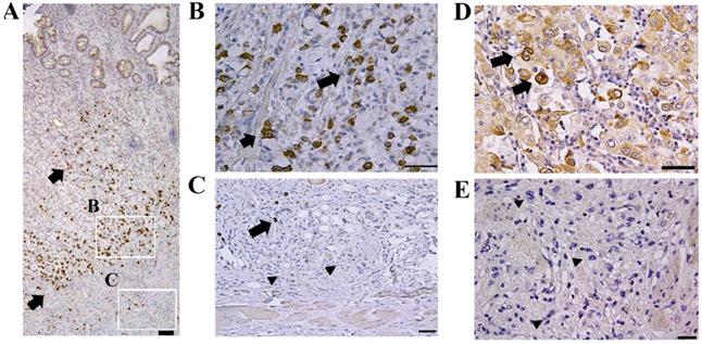 J Cancer Image