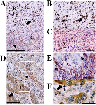 J Cancer Image