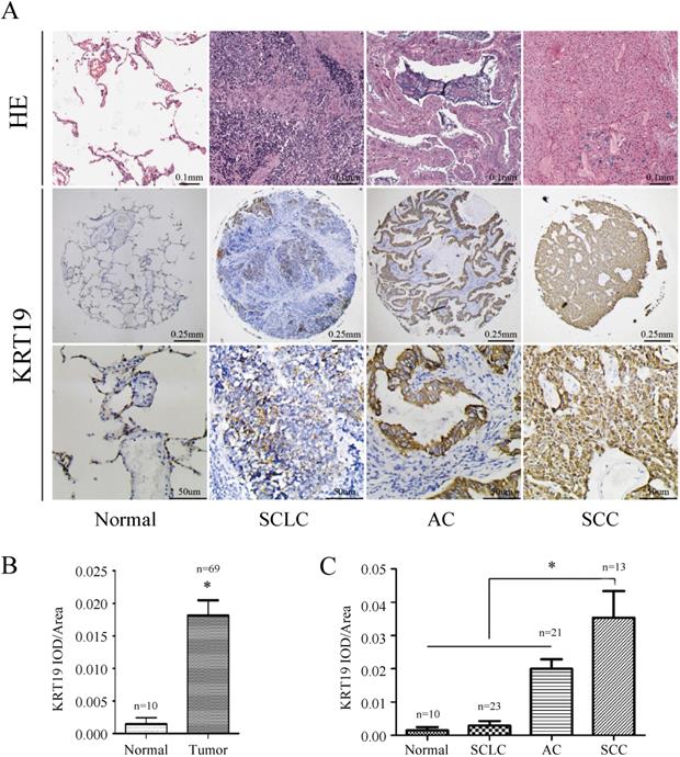 J Cancer Image