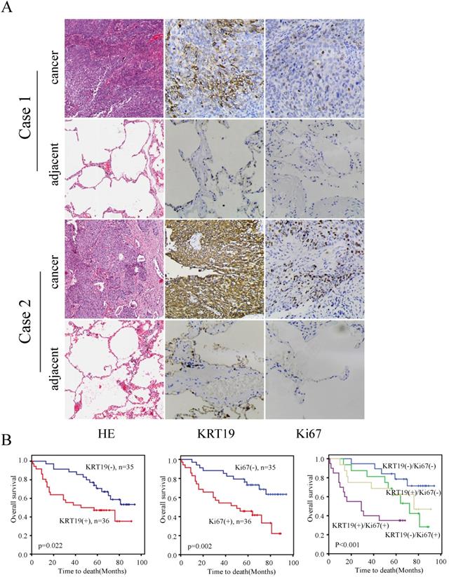 J Cancer Image