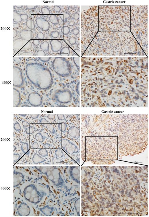 J Cancer Image