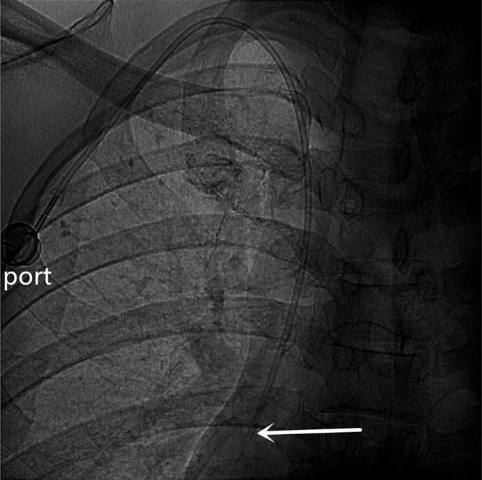 J Cancer Image