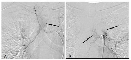 J Cancer Image