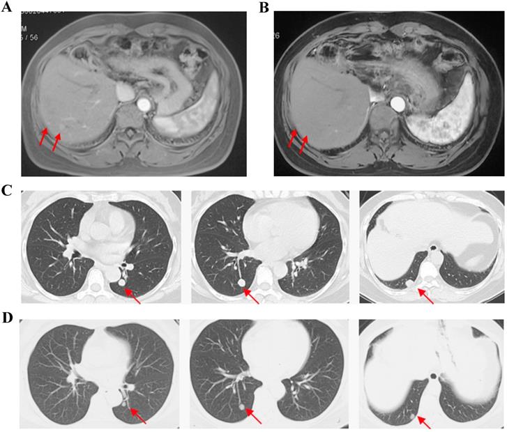 J Cancer Image