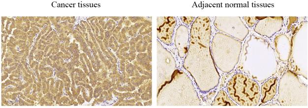 J Cancer Image