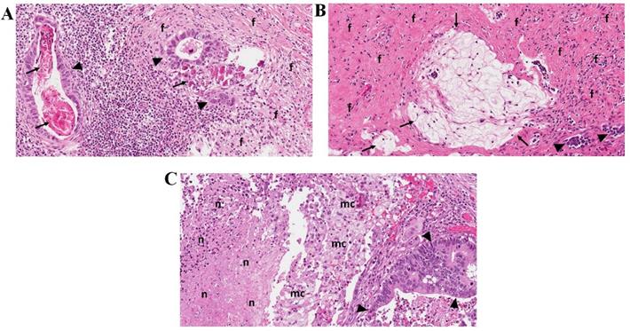 J Cancer Image