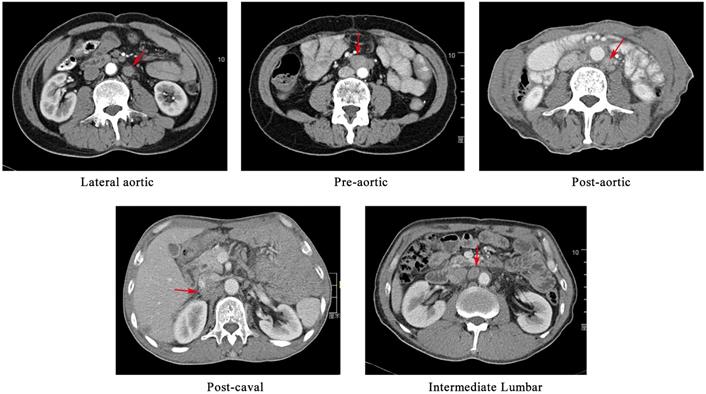 J Cancer Image