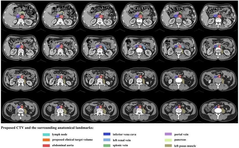 J Cancer Image