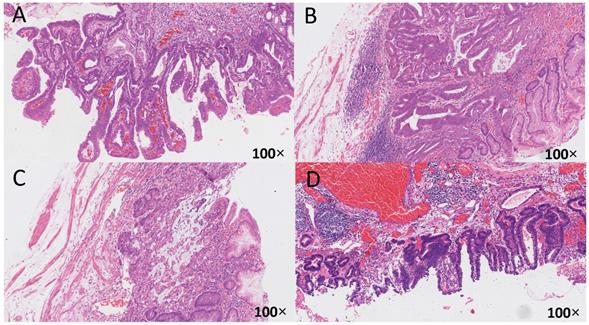 J Cancer Image