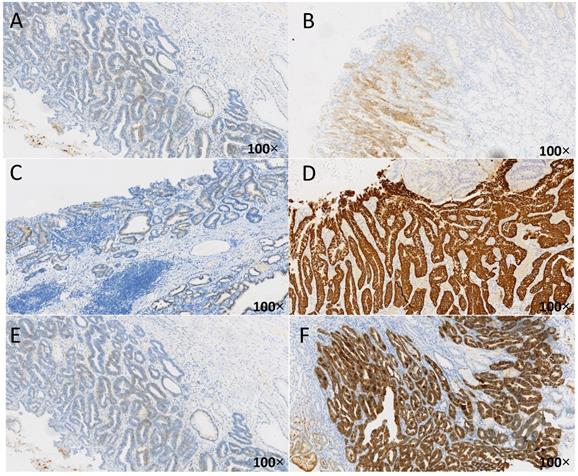 J Cancer Image