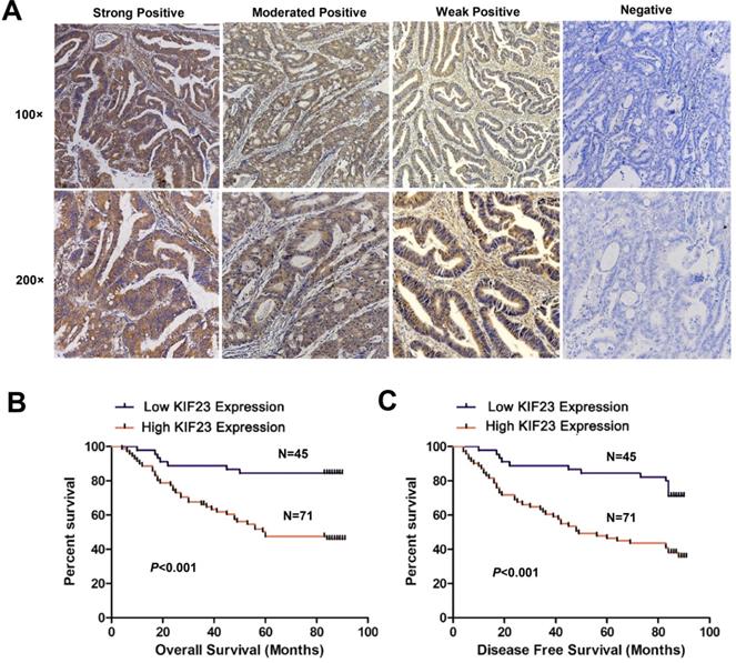 J Cancer Image