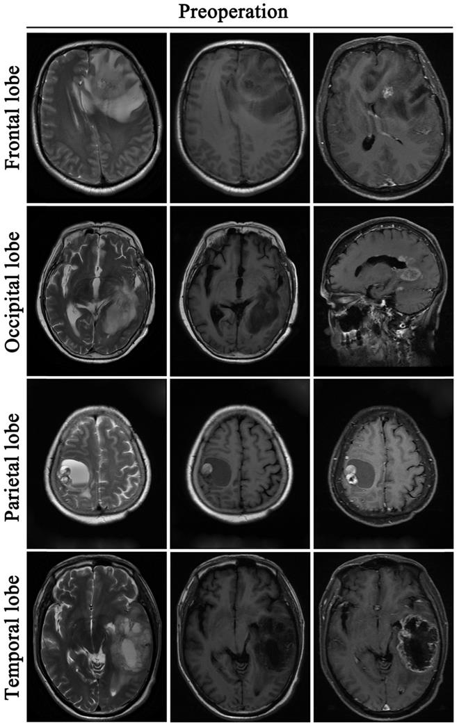 J Cancer Image