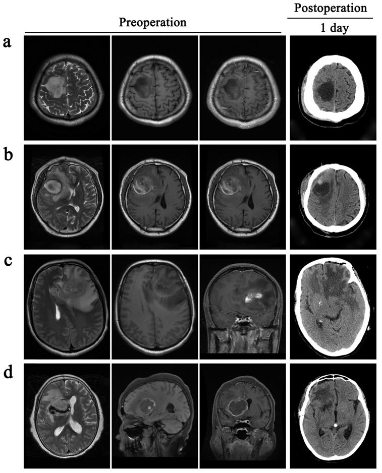 J Cancer Image