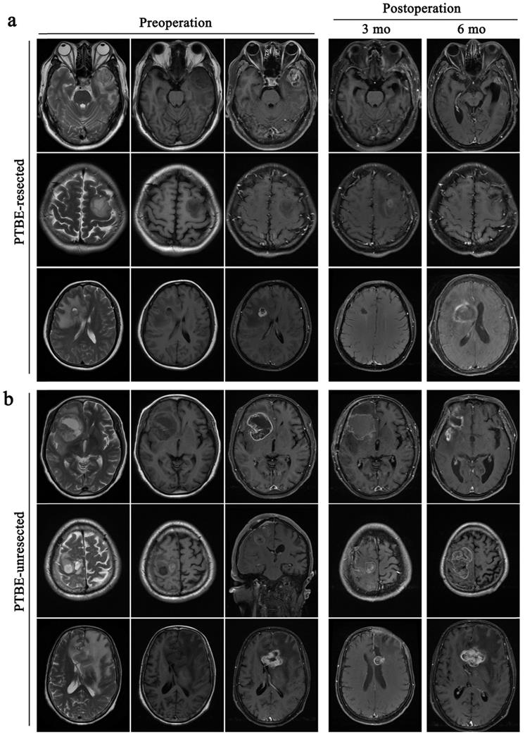 J Cancer Image