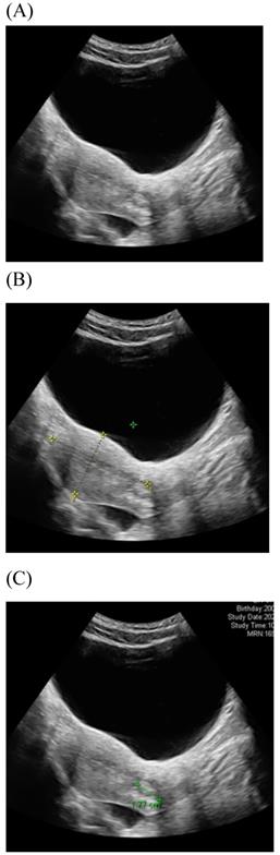 J Cancer Image