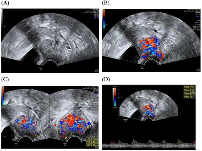 J Cancer Image