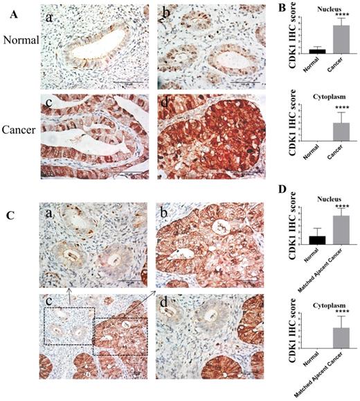 J Cancer Image