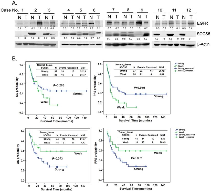 J Cancer Image