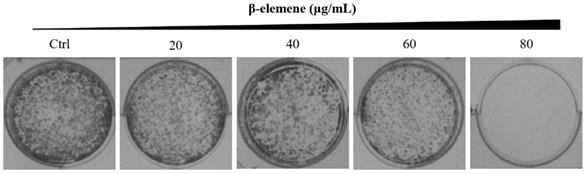 J Cancer Image