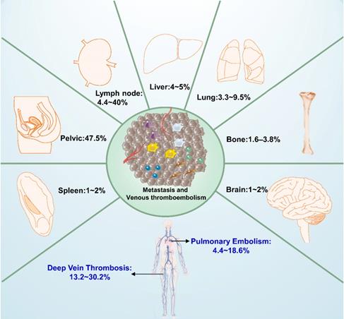 J Cancer Image