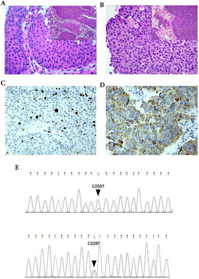 J Cancer Image