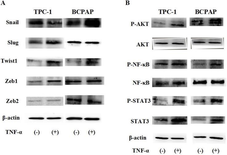 J Cancer Image