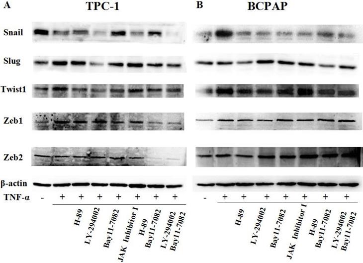 J Cancer Image