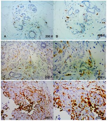 J Cancer Image