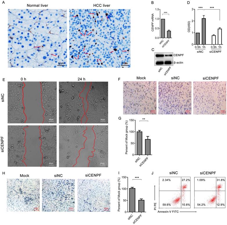 J Cancer Image