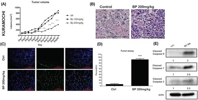 J Cancer Image