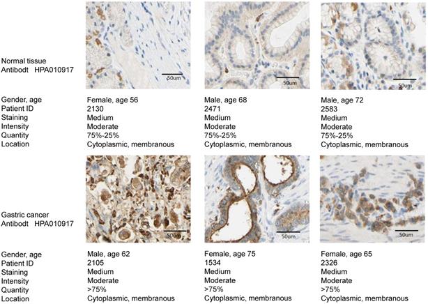 J Cancer Image