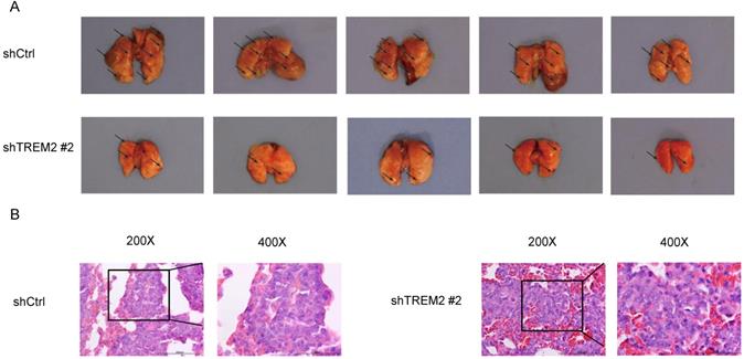 J Cancer Image