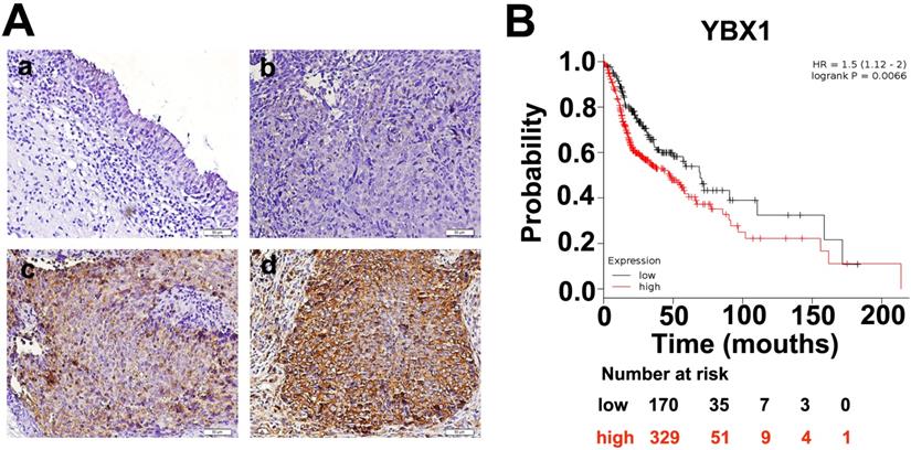 J Cancer Image