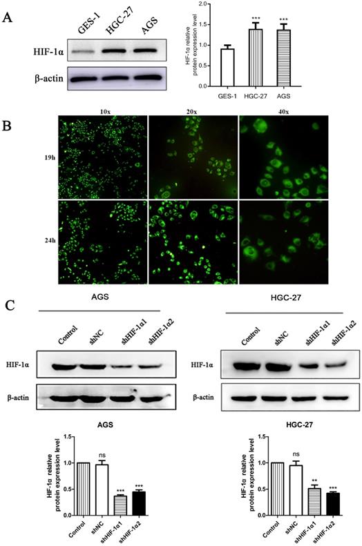 J Cancer Image