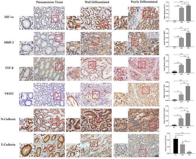 J Cancer Image