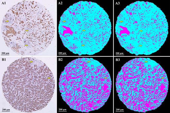 J Cancer Image