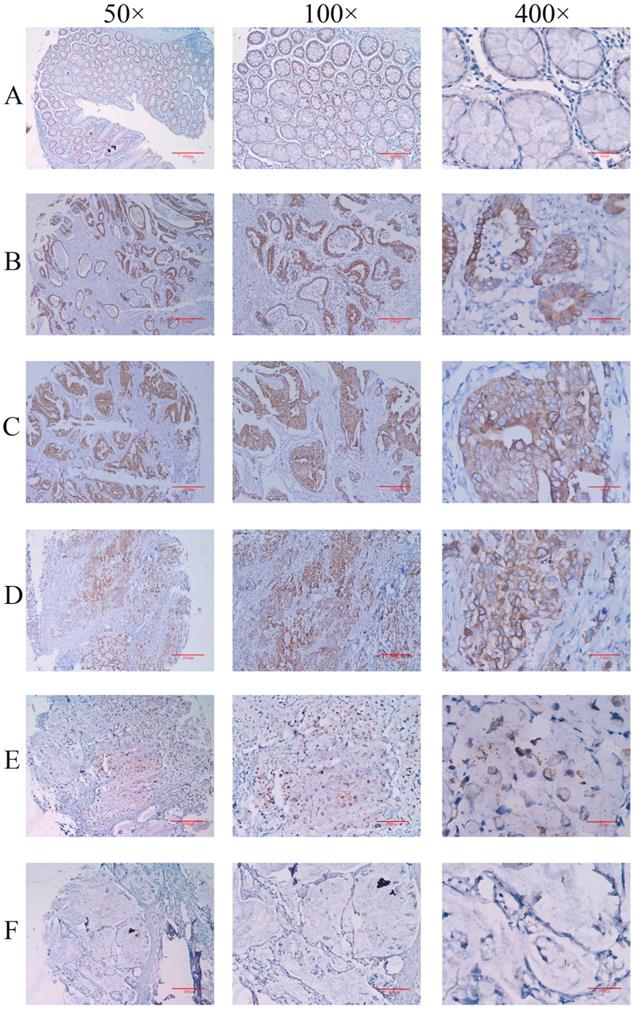 J Cancer Image