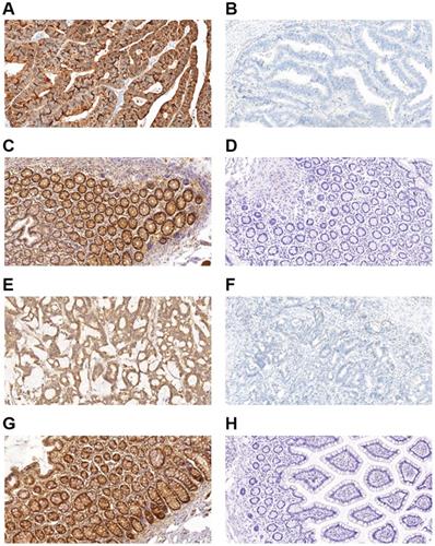 J Cancer Image