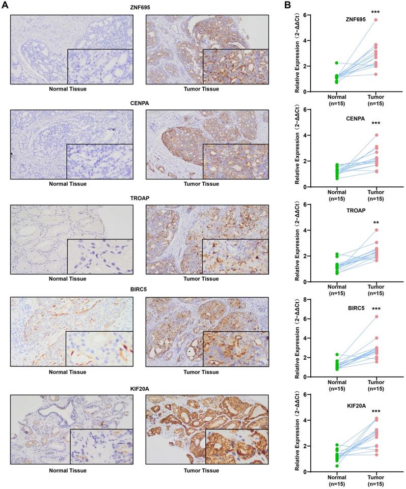 J Cancer Image