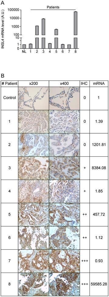 J Cancer Image