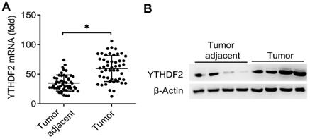 J Cancer Image