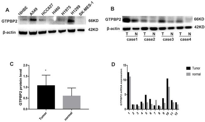 J Cancer Image