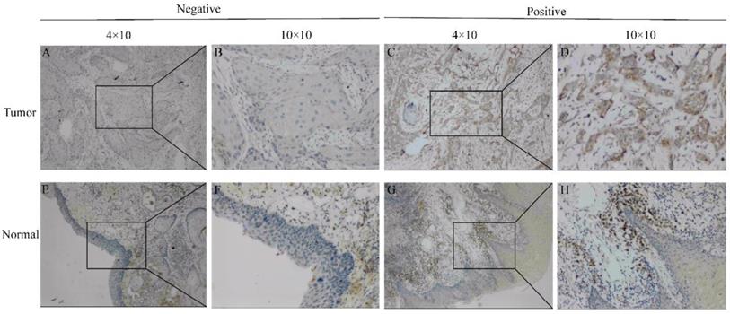 J Cancer Image