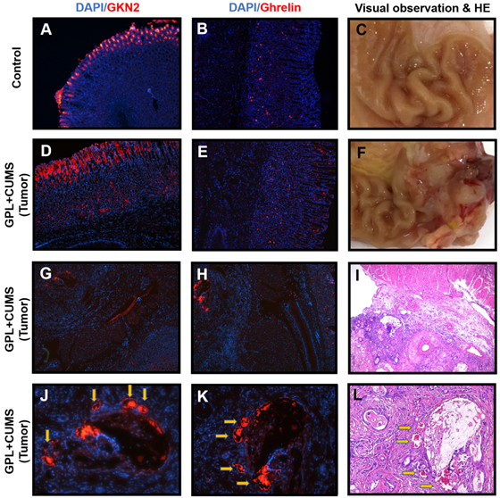 J Cancer Image