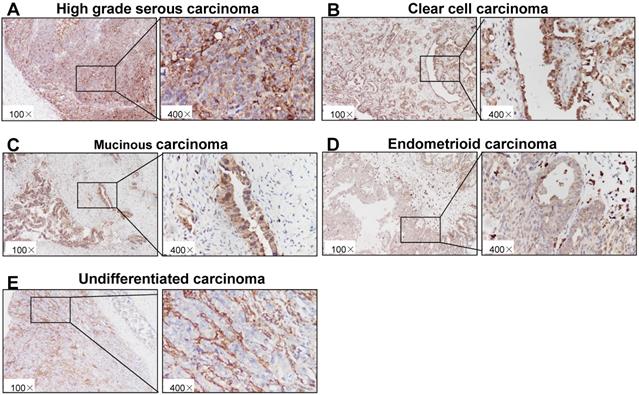 J Cancer Image