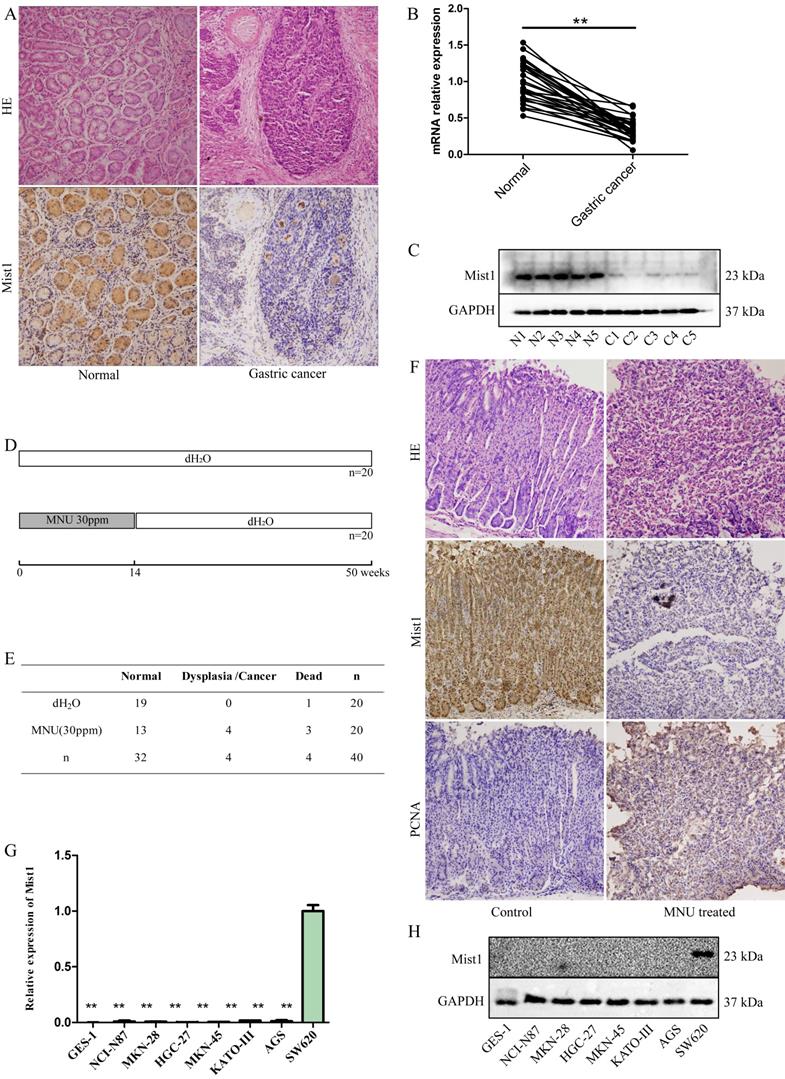 J Cancer Image