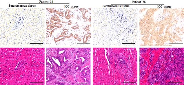 J Cancer Image