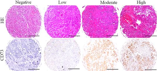 J Cancer Image