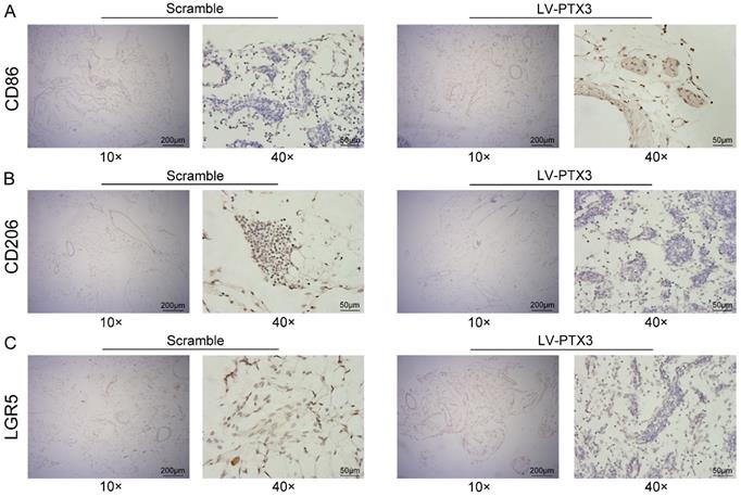 J Cancer Image